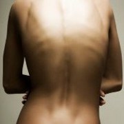 Anorexia Nervosa related image